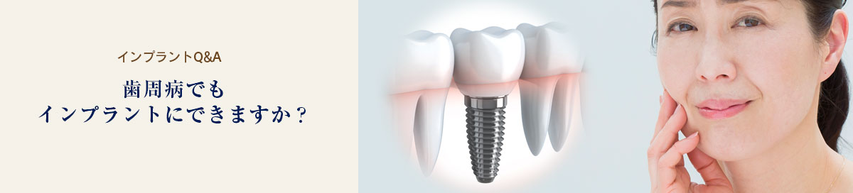 歯周病でもインプラントにできますか？