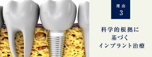 理由3 化学的根拠に基づくインプラント治療