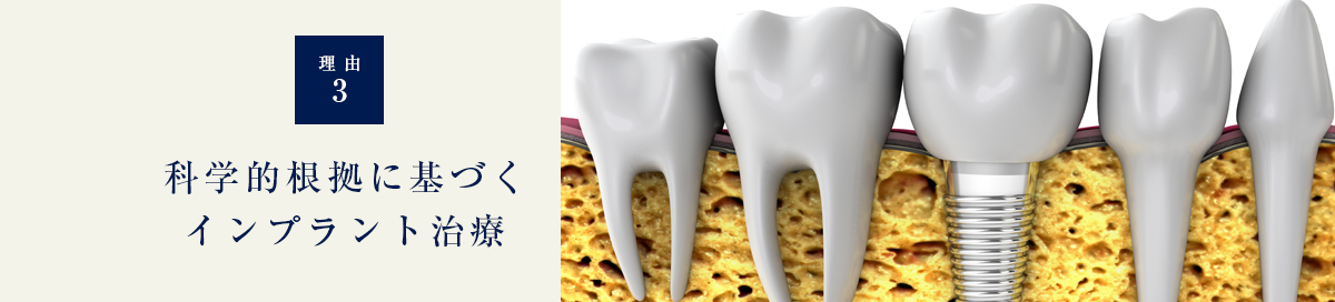 科学的根拠に基づくインプラント治療